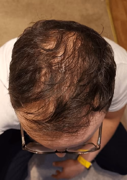 Mourad_Before