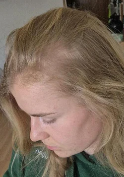 Sidsel_Before