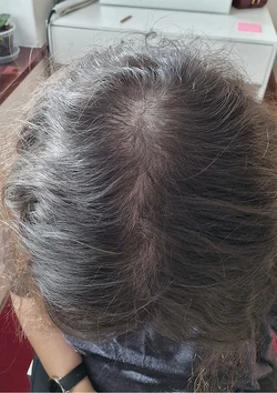 lora_after
