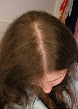 lora_before
