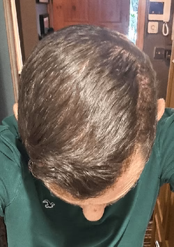 rick_after