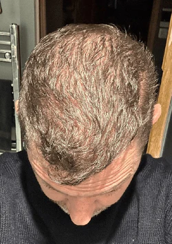 rick_before